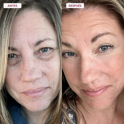 Bálsamo TODO-EN-UNO para renovar el contorno de ojos