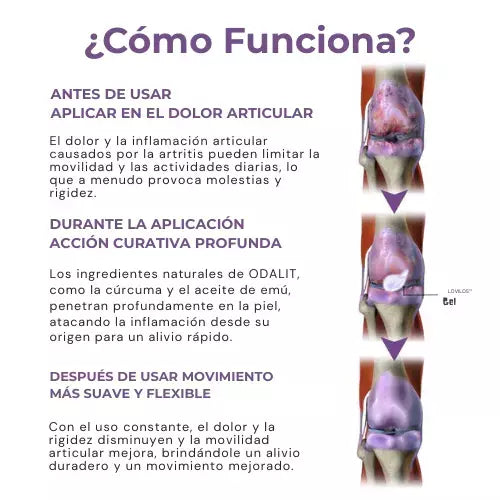 Gel de masaje Calmante para el Dolor